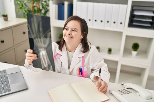 Mulher Com Síndrome Vestindo Uniforme Médico Segurando Raio Clínica — Fotografia de Stock