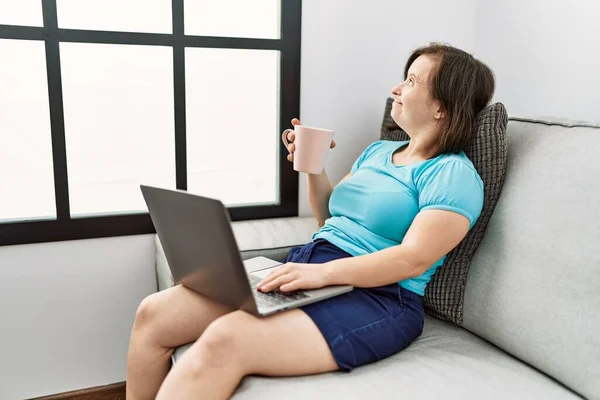 Mulher Morena Com Síndrome Sentado Sofá Usando Laptop Sala Estar — Fotografia de Stock