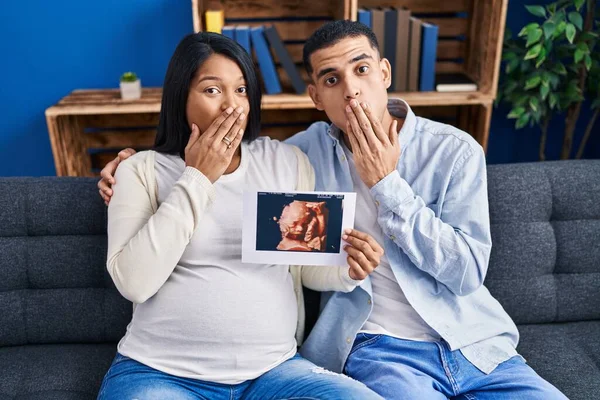 年轻的一对惊慌失措的夫妇期待着一个婴儿坐在沙发上 手拿着超声波捂住婴儿的嘴 震惊而又害怕犯错 惊讶的表情 — 图库照片