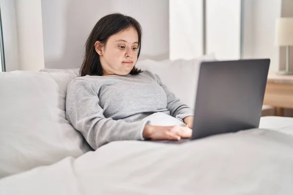 Young Woman Syndrome Using Laptop Sitting Bed Bedroom — Fotografia de Stock