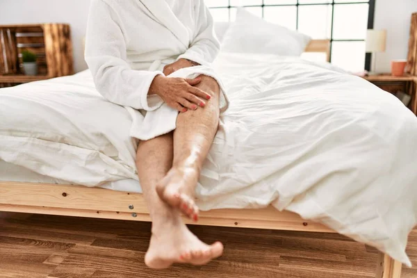 Middle Age Grey Haired Woman Massaging Legs Cream Sitting Bed — Stock Photo, Image