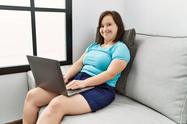 Mulher Morena Com Síndrome Sentado Sofá Usando Laptop Sala Estar — Fotografia de Stock