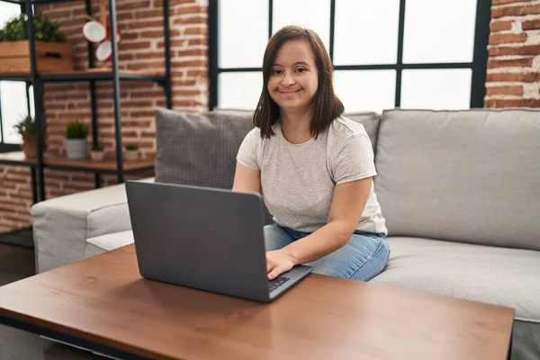 Frau Mit Syndrom Sitzt Mit Laptop Hause Auf Sofa — Stockfoto