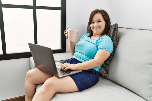 Sendromlu Esmer Kadın Oturma Odasında Dizüstü Bilgisayar Kullanarak Kanepede Oturuyor — Stok fotoğraf
