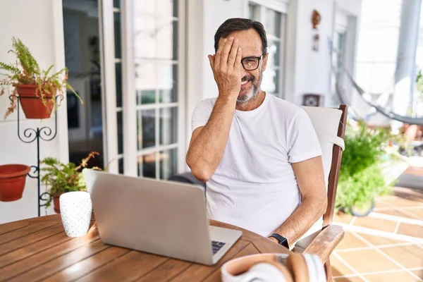Orta Yaşlı Bir Adam Evde Bilgisayar Kullanıyor Bir Gözünü Eliyle — Stok fotoğraf