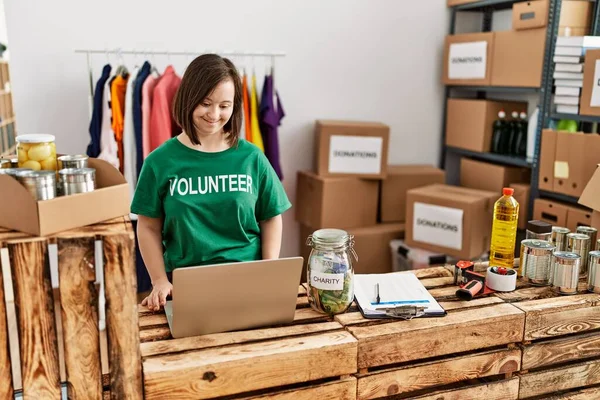 Brunette Vrouw Met Syndroom Werken Met Behulp Van Laptop Bij — Stockfoto