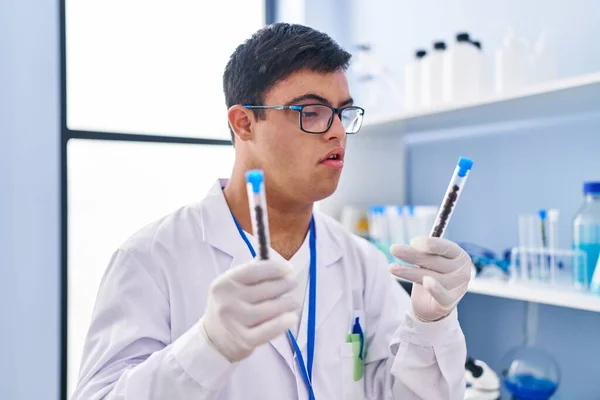 Homem Com Síndrome Vestindo Tubos Ensaio Uniforme Cientista Segurando Laboratório — Fotografia de Stock