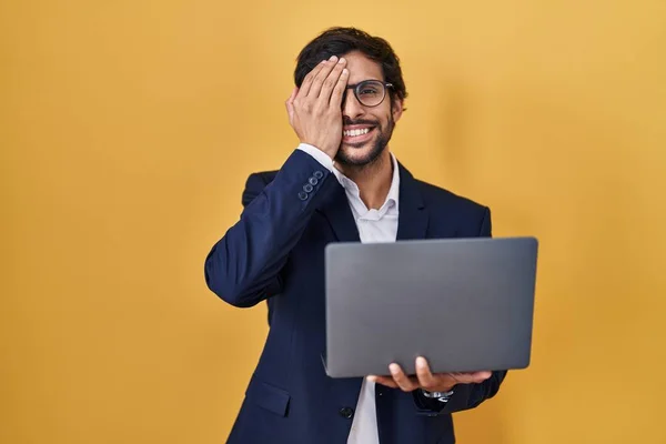 Handsome Latin Man Working Using Computer Laptop Covering One Eye — Stockfoto