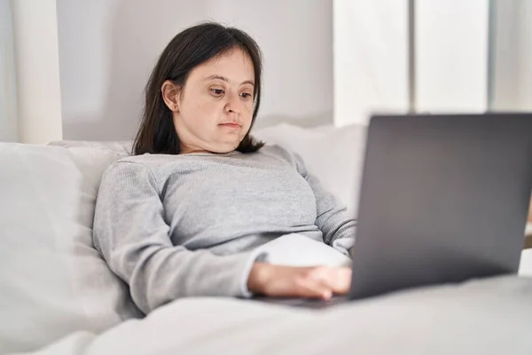 Young Woman Syndrome Using Laptop Sitting Bed Bedroom — Fotografia de Stock