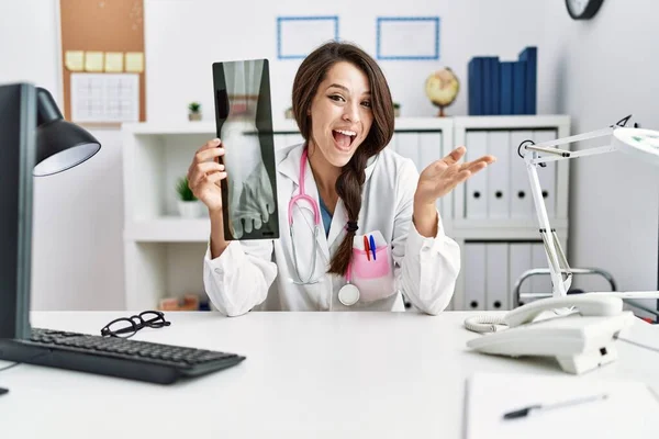 Ung Läkare Kvinna Som Håller Fot Röntgen Firar Prestation Med — Stockfoto