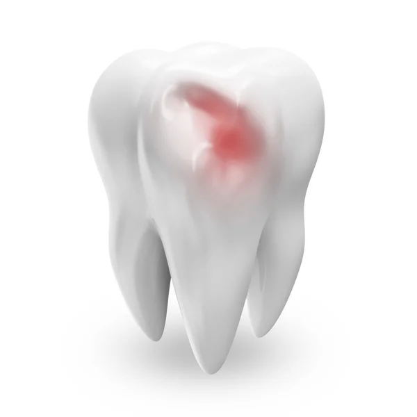 Хвороба Зуб ізольований на білому тлі — стокове фото