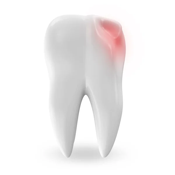 Enfermedad Diente aislado sobre fondo blanco —  Fotos de Stock