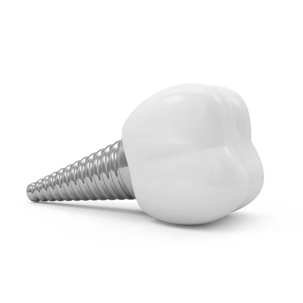 Tooth Implant isolated on white background — Stock Photo, Image