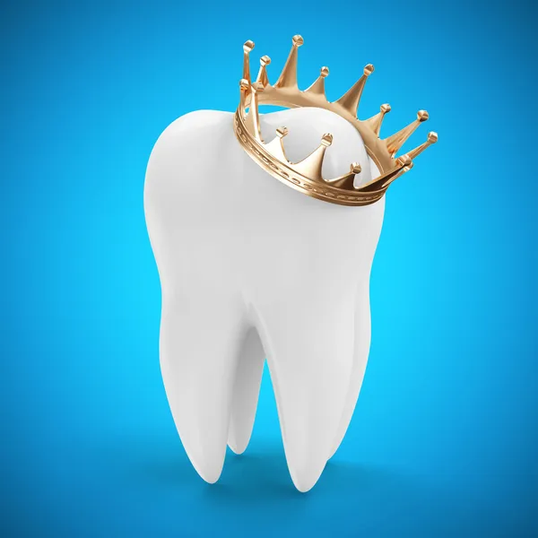 Dente con corona d'oro — Foto Stock