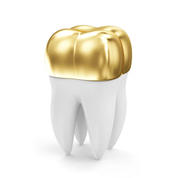 Coroa Dental Dourada em um dente — Fotografia de Stock