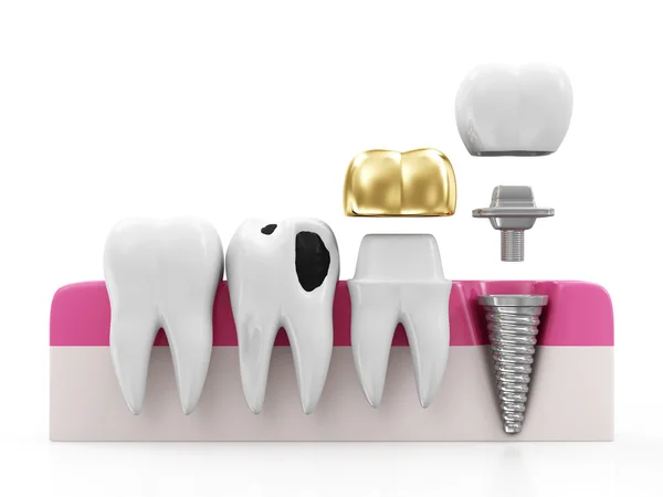 Dentistry Concept — Stock Photo, Image