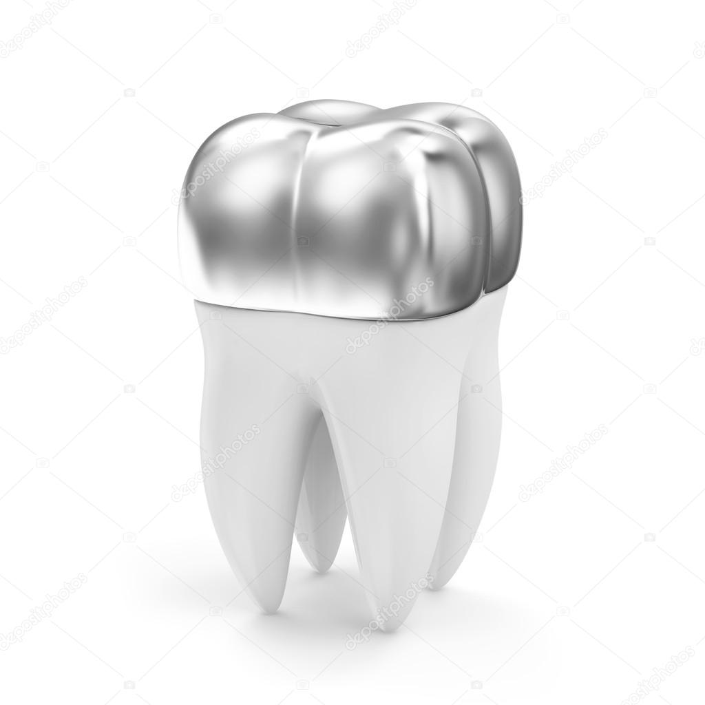 Silver Dental Crown on a Tooth — Stock Photo © rasslava 49475173