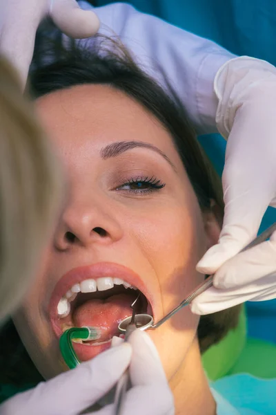 Detailní Čistá Zubní Prohlídka Ženských Zubech Zubní Ordinaci — Stock fotografie