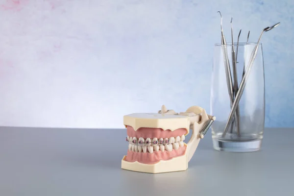 Demonstrationsmodell Des Kiefers Mit Einem Metallbügelsystem Mit Einem Glas Zahnärztlicher — Stockfoto