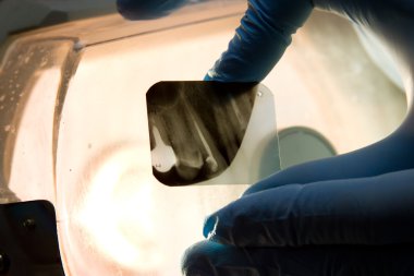 Panoramik diş röntgeni