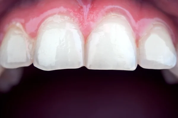 Dişlerin arka plan — Stok fotoğraf