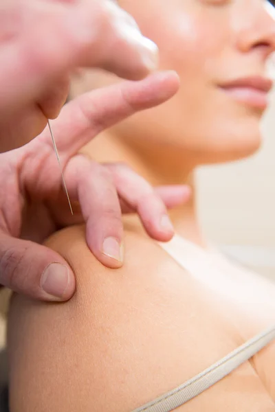 Doctor hands acupuncture needle pricking on woman — Stock Photo, Image