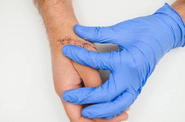 Kolunda kesik olan bir doktor tarafından muayene edildi.