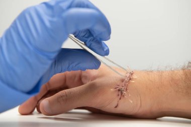 Kolunda kesik olan bir doktor tarafından muayene edildi.