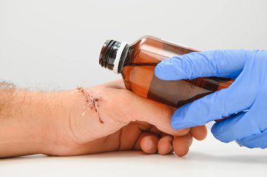 Kolunda kesik olan bir doktor tarafından muayene edildi.