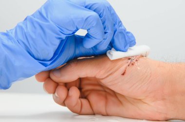 Kolunda kesik olan bir doktor tarafından muayene edildi.