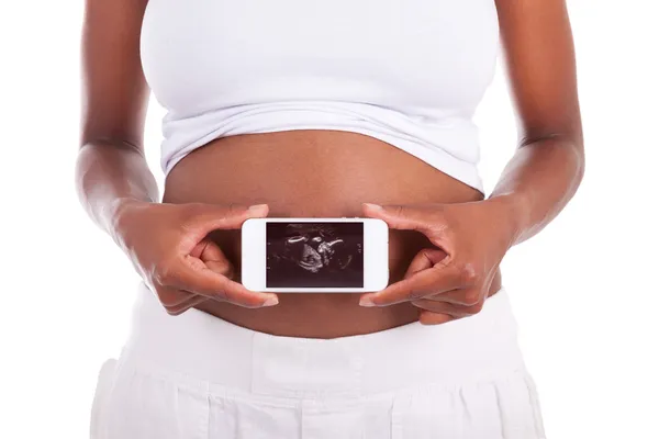 Young pregnant black woman showing an ultrasound picture of her — Stock Photo, Image