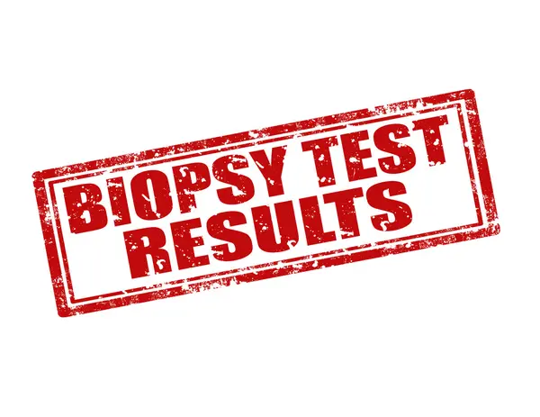 Результаты биопсического теста — стоковый вектор
