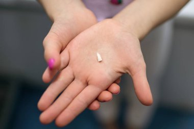 Milk tooth in the palm of a child close-up. The child holds his first deciduous tooth in the palm of his hand with painted nails. Cute baby is waiting for the tooth fairy