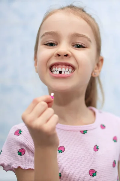 Holčičí Dítě Ukazuje Ústa Bez Jednoho Chybějícího Mléčného Zubu Dívka — Stock fotografie