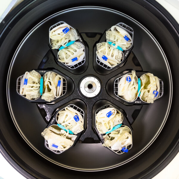Separation of serum and blood cells in centrifuge.