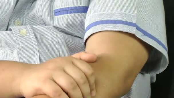 Boy with allergy skin scratch itchy arm — Stock Video