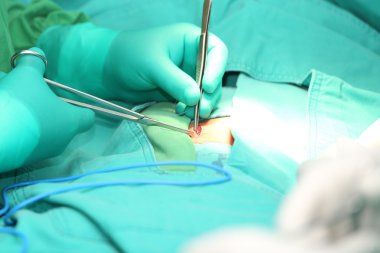 Surgeon hands suturing an hernia clipart