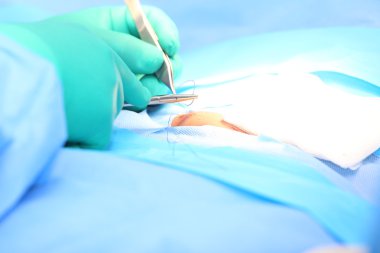 Doktor bir fıtık dikiş. odak araçları