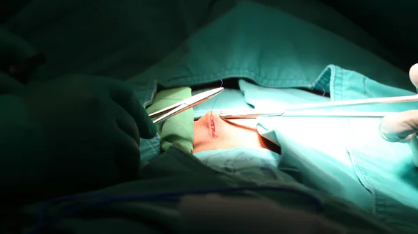 Fechar de uma sutura em uma cirurgia — Fotografia de Stock
