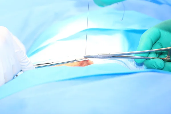 Doktor dikiş açık yara