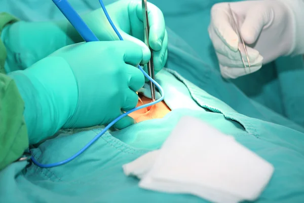 Médecin utilisant un scalpel électronique dans une chirurgie — Photo