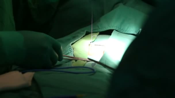 Medical team performing an operation — Stock Video