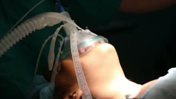 Неопознанная девушка дышит кислородной маской в операционной. — стоковое видео