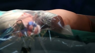 Tanımlanamayan bebek bir cerrah tarafından ameliyat olmak hazır