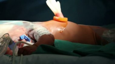 cerrah operasyon öncesi iyot çözüm uygulama
