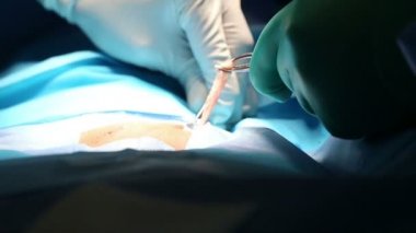 Cerrahi aletler fıtık ameliyatı üzerinde kullanma