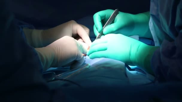 Surgeon operating with scalpel — Stock Video