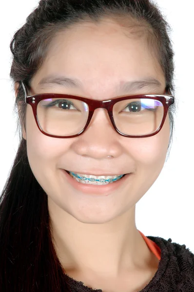Potret gadis muda asia dengan kacamata dan kawat gigi — Stok Foto