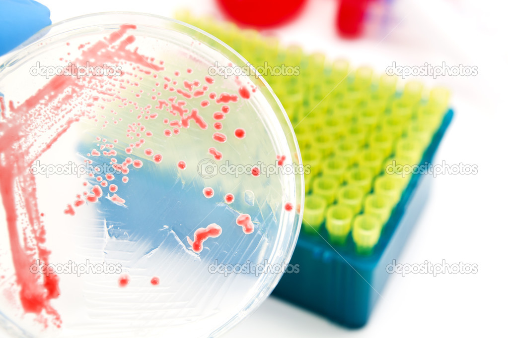 Genetically modified microorganisms