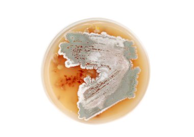 Streptomyces agar plaka üzerinde
